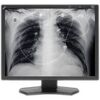 NEC 21" Grayscale 3-Megapixel Medical Diagnostic Monitors with Graphics Card (2)